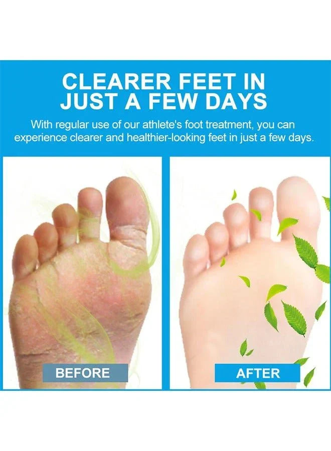 Sumifun - Foot Anti-Bacterial Cream (Original)